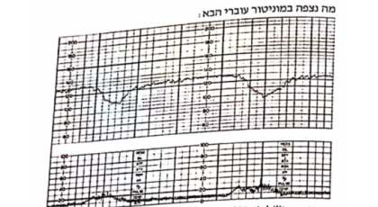 תמונה לשאלה מס. 135
